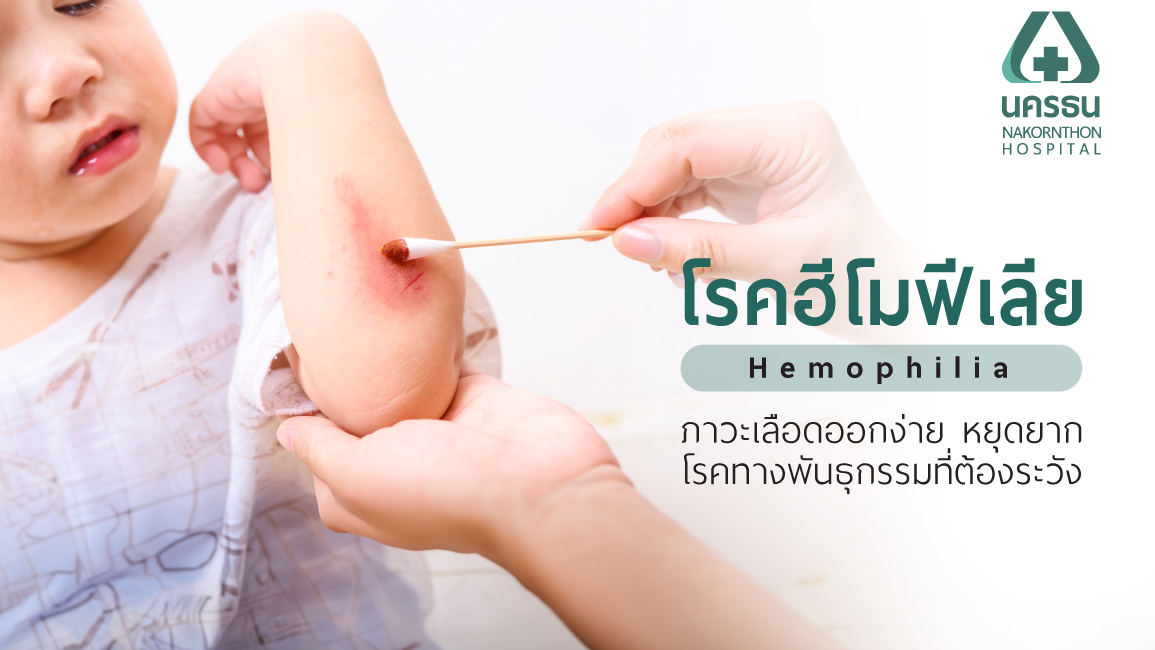 โรคฮีโมฟีเลีย
